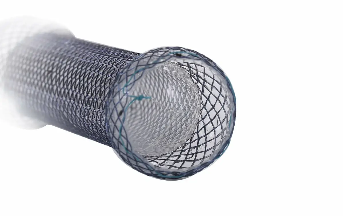 Anti Reflux Oesophageal Stent